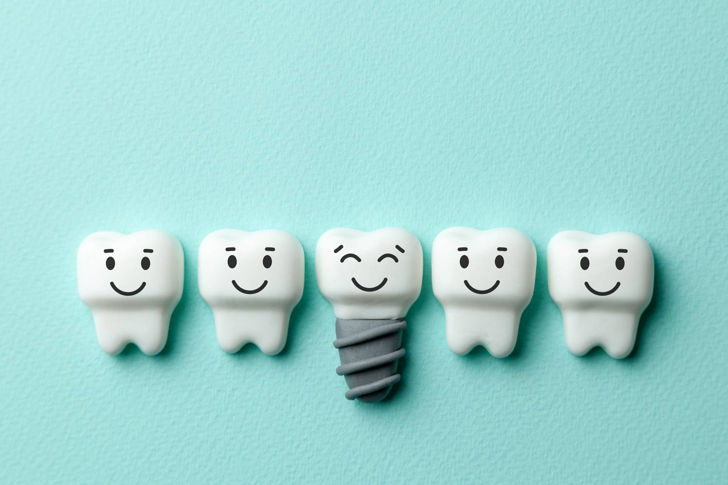 Przeciwwskazania do implantów dentystycznych